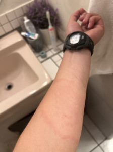 bottom of arm