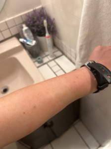 top of arm